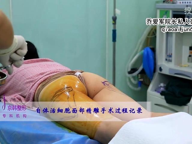 【大腿,臀部】抽脂手术完整视频实拍曝光?-健康视频-搜狐视频