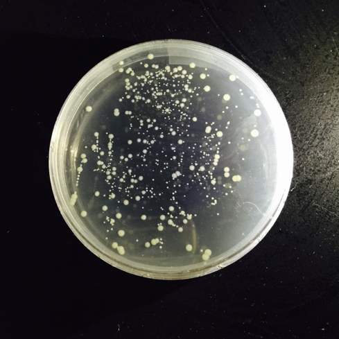 培养大肠杆菌时出现异常菌落,请问是否为杂菌?