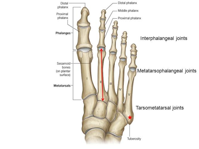  p>跗跖关节,由三块楔骨和骰骨的远侧面与5个跖骨底构成.