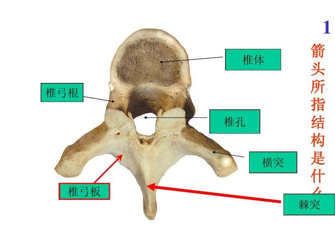 1 椎体 椎弓根 椎孔 横突 椎弓板 箭 头 所 指 结 构 是 什 么 棘突 ?