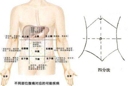 肚子上面是什么部位腹部哪些位置疼痛要注意