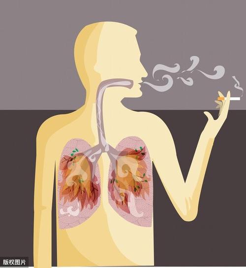 有人一直吸烟肺干干净净有人从不吸烟却查出肺癌