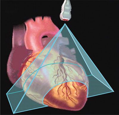 动态三维超声心动图对冠心病左心功能的测量分析