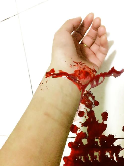 手腕割破流血真实图片