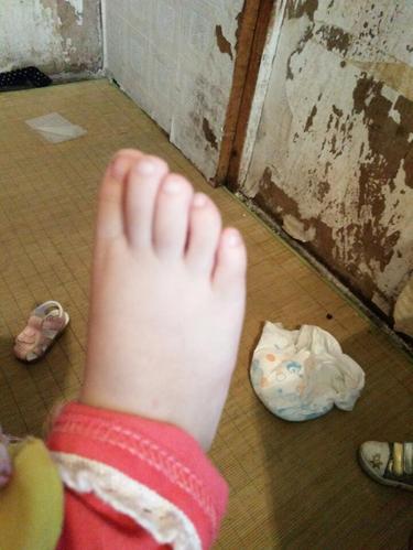 宝宝的到数第二个脚趾头有点弯,还被第一个有时候压着,可以张开的