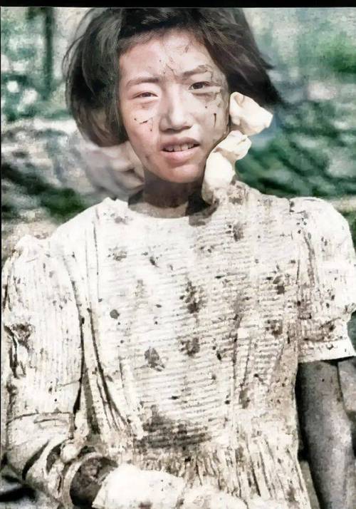 1945年,广岛原子弹轰炸后一名幸存女孩照片,眼神迷茫地望向镜头_滕井