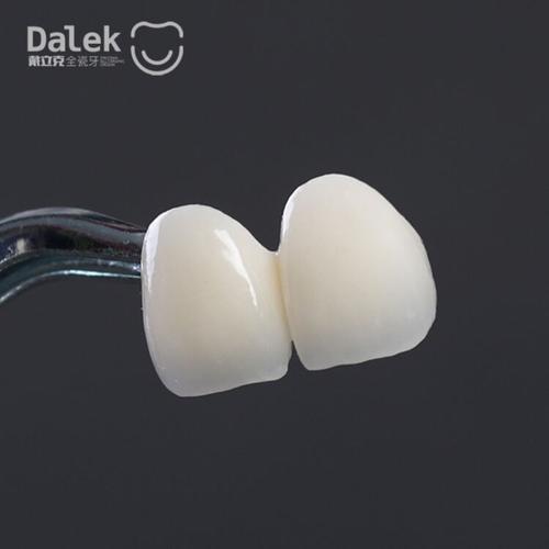 dalek 戴立克二氧化锆全瓷牙烤瓷牙套牙冠牙齿假牙美白牙齿 3m蛀牙