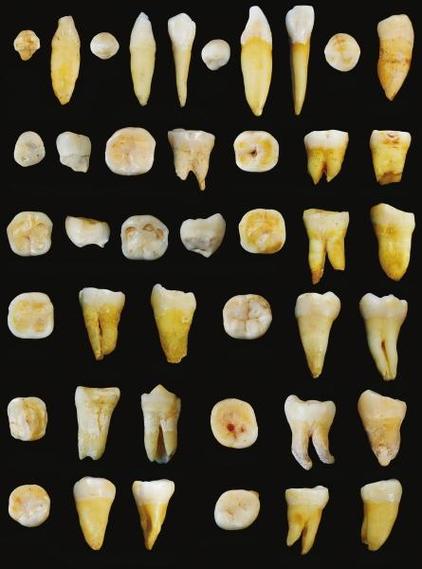 中国发现17.8万年前人类牙齿:早于人类走出非洲时间