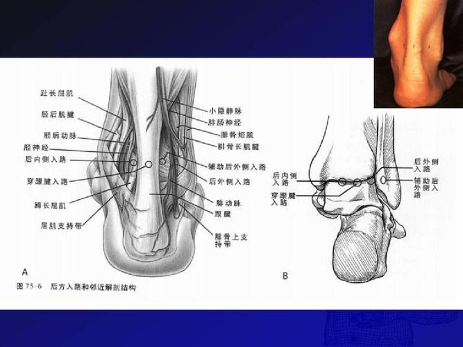 踝关节镜技术在治疗踝关节疾病中的应用ppt