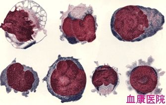 原始巨核细胞核幼稚巨核细胞模式图  医学教育网整理