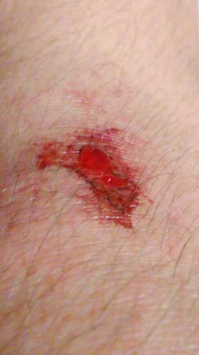 我在膝盖下面摔出了一个伤口,大约什么时候能好?看起来出了蛮多血.