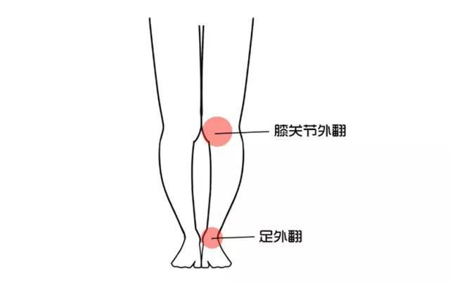 形成xo型腿最常见的原因还是由于坐姿和站姿的不正确,比如说跷二郎腿