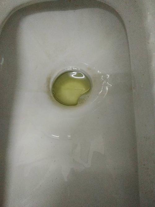 最近这两天尿尿有泡沫,不知道怎么回事,泡沫不大,也不多,但是十分