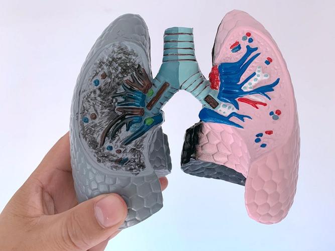 吸烟肺与健康肺模型呼吸肺与支气管教具人体内脏呼吸病理对比演示