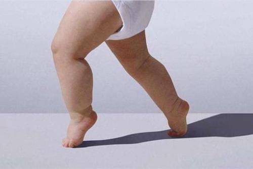 宝宝腿部发育不良造成小短腿这些陋习还在用尽量避免