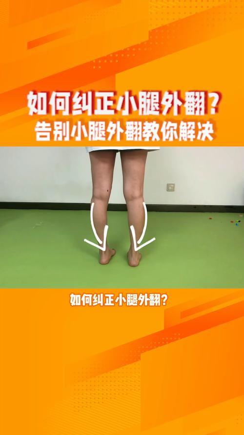 小腿外翻是由什么原因导致的呢