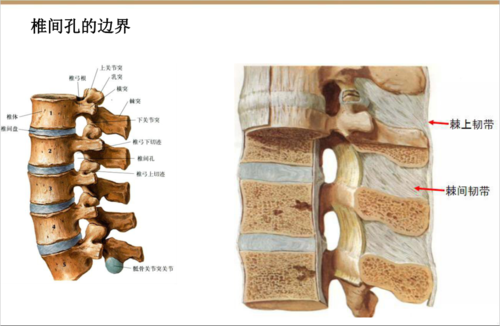 收藏版椎间孔镜技术脊柱应用解剖图表