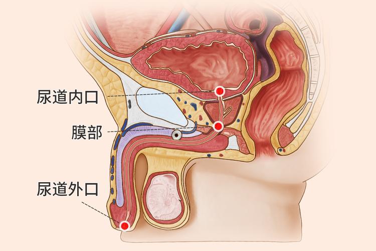 男性尿道三个狭窄,分别位于尿道内口,尿道膜部,尿道外口.