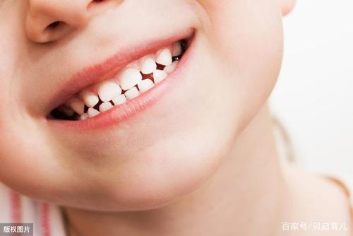 欢迎留言讨论,你家孩子的牙齿长的整齐吗?