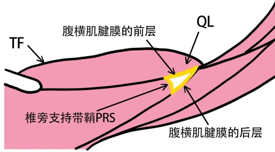 腰筋膜三角(lumber interfascial triangle,lift):由竖脊肌外侧缘,椎