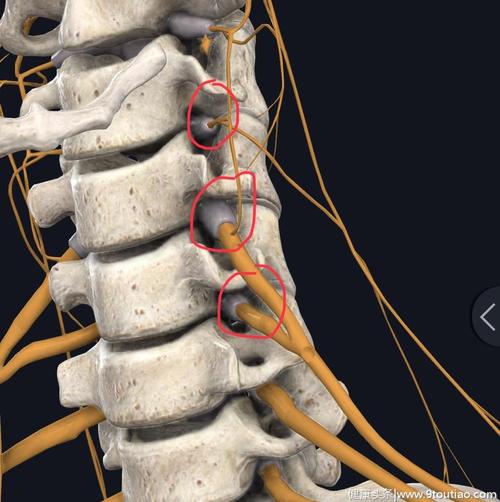 当神经从脊髓发出后,遇到了第一个狭窄的"山谷",这个山谷叫做椎间孔