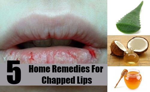 super chapped lips while pregnant