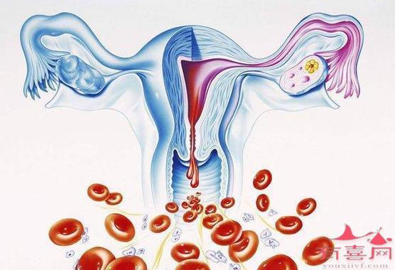 子宫异常出血的原因有哪些