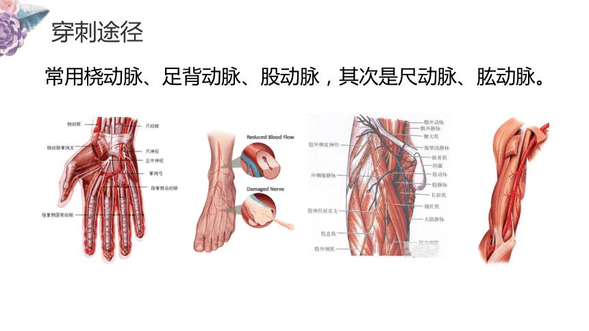 动脉穿刺术桡动脉和股动脉pptppt