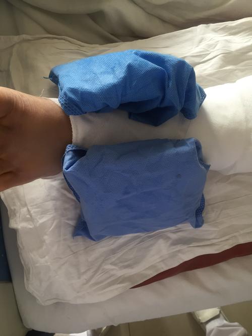 以前,我们科室会用成装无菌物品的蓝色包布袋盛放冰块为病人冷敷.