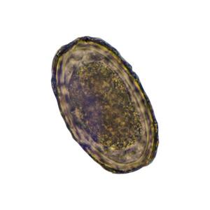 蛲虫卵显微镜下发现蛔虫虫卵.照片