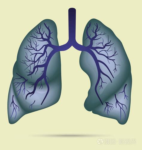 人肺解剖哮喘肺结核肺炎肺肿瘤图中详细说明呼吸或呼吸系统矢量
