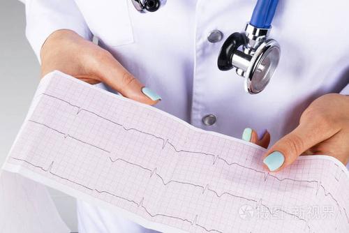 心电图的一名女医生的手中医疗健康服务临床心脏病学心脏节律和脉冲