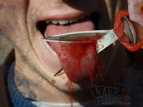 18世纪末,普鲁士大夫治疗口吃的办法是将患者舌头剪掉一部分