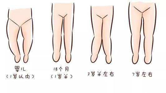 婴儿腿型变化过程图