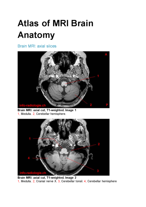 anatomy brain mri axial slices brain mri axial :磁共振脑解剖脑