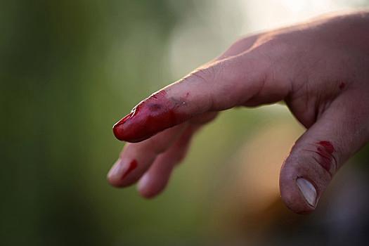 手指,伤口,特写,食指,右边,手,受伤,出血,鲜明,红色,血,户外,晴天