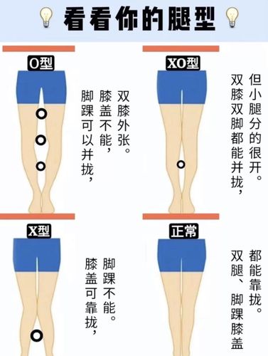 腿型自测你是哪一种?