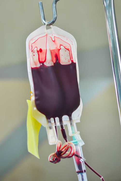 正在输血的血袋