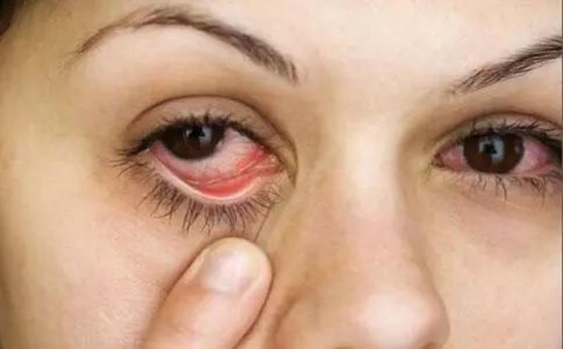 【警惕】眼睛一旦出现这8种症状要当心,这可能是大病