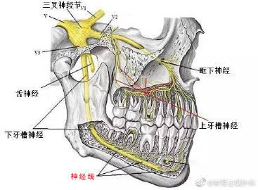 我们指的神经线是下颌神经管里的下牙槽神经,属于感觉神经.