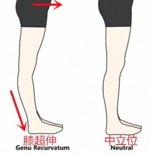 拉伸动作小腿按摩3,纠正姿势正确的坐姿和站姿也十分重要,尤其是走路