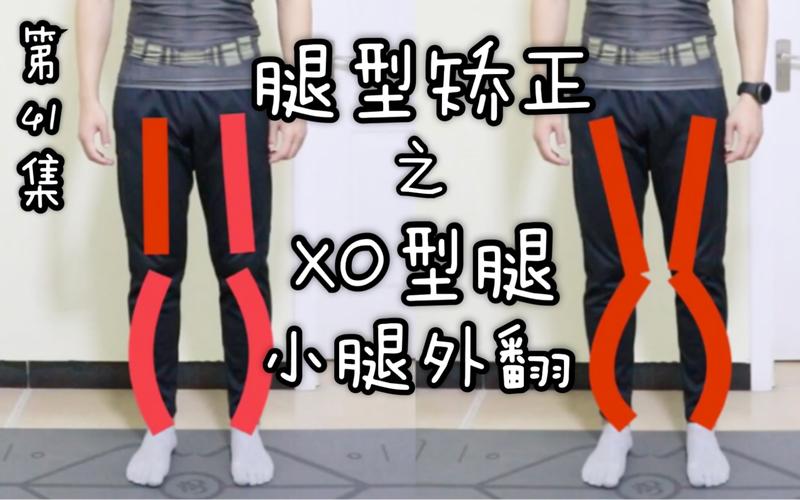 xo型腿小腿外翻矫正快来看科学的方法3招快速瘦小腿改善腿型