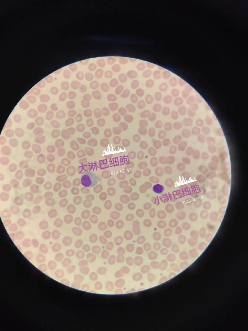 来认识一下我们血液里的正常白细胞吧😁#显微镜下的世界 - 抖音