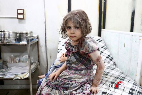 战争之殇:叙利亚内战受伤儿童照片令人心碎(组图)
