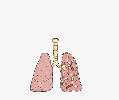 卡通漫画吸烟者的肺