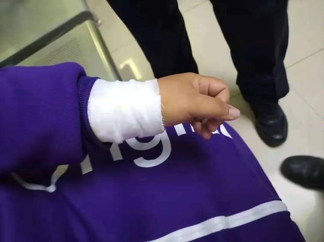 女子左手腕已有割腕痕迹,好在伤口并不严重,民警随即将她送往医院包扎